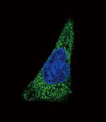 SLC11A2 Antibody in Immunocytochemistry (ICC/IF)