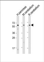 SLC11A2 Antibody in Western Blot (WB)