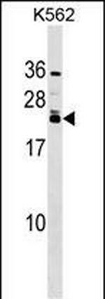 HAND2 Antibody in Western Blot (WB)