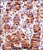 RBPJ Antibody in Immunohistochemistry (Paraffin) (IHC (P))