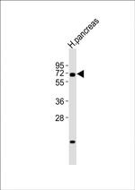 RBPJ Antibody in Western Blot (WB)