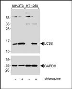 LC3B Antibody in Western Blot (WB)