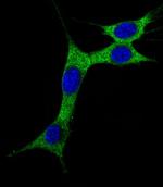 LC3A (Cleaved Gly120) Antibody in Immunocytochemistry (ICC/IF)