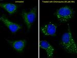 LC3A (Cleaved Gly120) Antibody in Immunocytochemistry (ICC/IF)