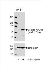 LC3A (Cleaved Gly120) Antibody in Western Blot (WB)