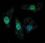 ATG7 Antibody in Immunocytochemistry (ICC/IF)