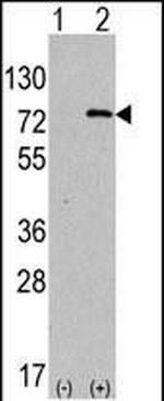 ATG7 Antibody in Western Blot (WB)