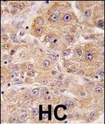 UVRAG Antibody in Immunohistochemistry (Paraffin) (IHC (P))