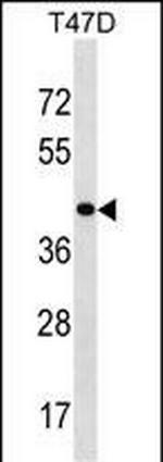 HOXD8 Antibody in Western Blot (WB)