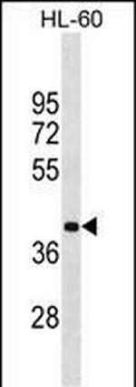 MBD2 Antibody in Western Blot (WB)