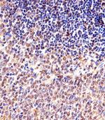 Cyclin B1 Antibody in Immunohistochemistry (Paraffin) (IHC (P))