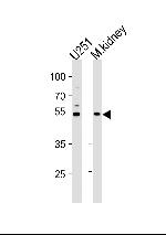 C1GALT1 Antibody in Western Blot (WB)