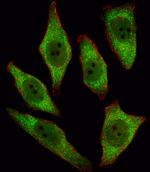 APRT Antibody in Immunocytochemistry (ICC/IF)