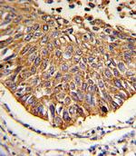 MDH2 Antibody in Immunohistochemistry (Paraffin) (IHC (P))