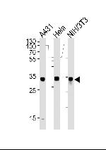 MDH2 Antibody in Western Blot (WB)