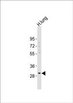 Kallikrein 6 Antibody in Western Blot (WB)