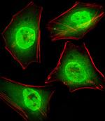 GTF2I Antibody in Immunocytochemistry (ICC/IF)