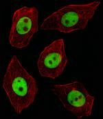 GTF2I Antibody in Immunocytochemistry (ICC/IF)