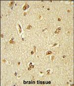 GTF2I Antibody in Immunohistochemistry (Paraffin) (IHC (P))