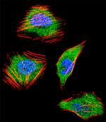 SMAD4 Antibody in Immunocytochemistry (ICC/IF)