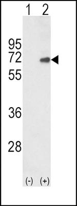 SMAD4 Antibody in Western Blot (WB)