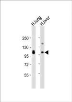 AOC3 Antibody in Western Blot (WB)