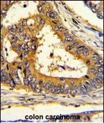 SCAP Antibody in Immunohistochemistry (Paraffin) (IHC (P))