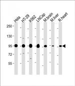 SCAP Antibody in Western Blot (WB)