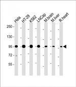 SCAP Antibody in Western Blot (WB)