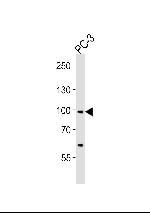 SCAP Antibody in Western Blot (WB)