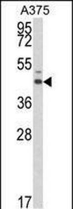 ESRRA Antibody in Western Blot (WB)