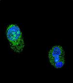 HNF1A Antibody in Immunocytochemistry (ICC/IF)