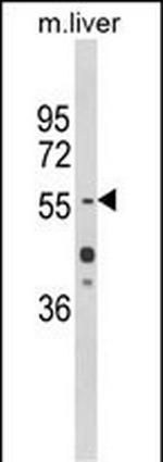 HNF1A Antibody in Western Blot (WB)