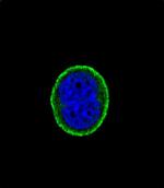 IL10RA Antibody in Immunocytochemistry (ICC/IF)