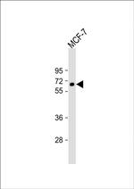 IL10RA Antibody in Western Blot (WB)