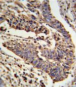 alpha-ENaC Antibody in Immunohistochemistry (Paraffin) (IHC (P))