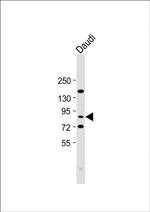 alpha-ENaC Antibody in Western Blot (WB)