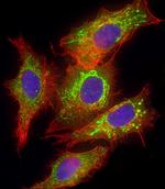 Glutaminase Antibody in Immunocytochemistry (ICC/IF)