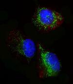 Glutaminase Antibody in Immunocytochemistry (ICC/IF)