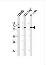 Glutaminase Antibody in Western Blot (WB)