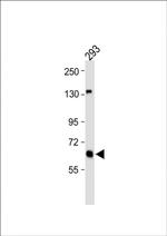 Glutaminase Antibody in Western Blot (WB)