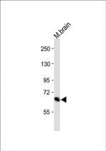 Glutaminase Antibody in Western Blot (WB)