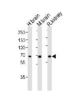 Glutaminase Antibody in Western Blot (WB)