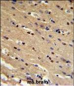 p73 Antibody in Immunohistochemistry (Paraffin) (IHC (P))