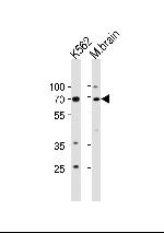 p73 Antibody in Western Blot (WB)