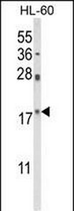 PIN1 Antibody in Western Blot (WB)