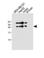 EMX1 Antibody in Western Blot (WB)