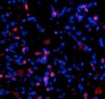 Procollagen I N-Peptide Antibody in Immunohistochemistry (IHC)