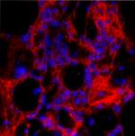 Procollagen I C-Peptide Antibody in Immunohistochemistry (IHC)