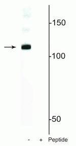 Phospho-DGCR8 (Ser377) Antibody in Western Blot (WB)